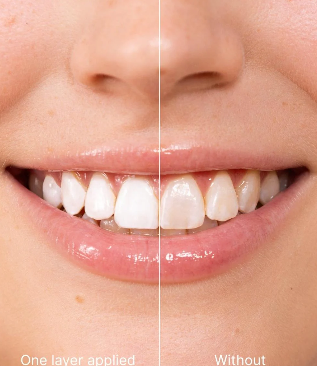 Teeth Polish - Instant White Teeth