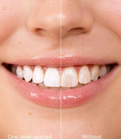 Teeth Polish - Instant White Teeth